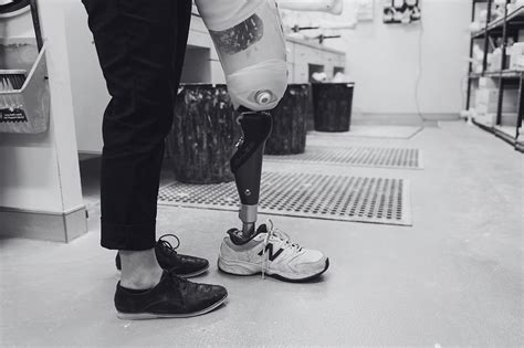 Lower Limb Orthotics Interface Orthotics West Perth