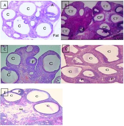 Histopathology Of The Pcos Rat S Ovaries Images A E Shows The