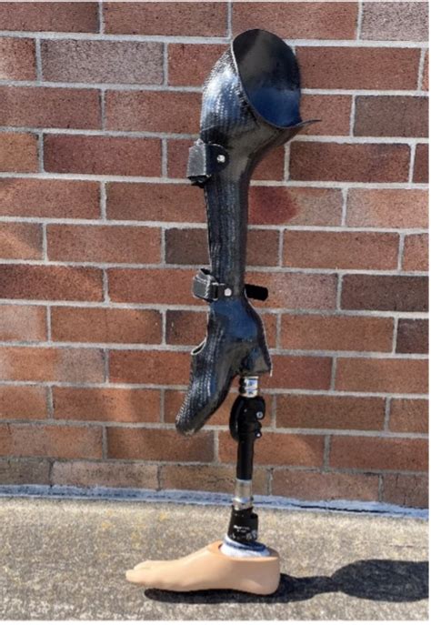 Prosthetic Leg Leg Prosthesis Apc Prosthetics