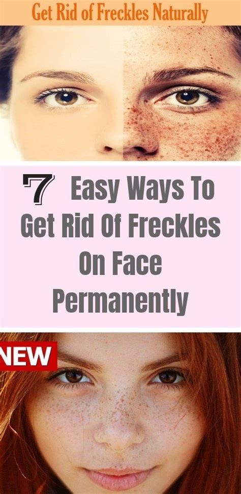 7 Easy Ways To Get Rid Of Freckles On Face Permanently Getting Rid Of Freckles Home Remedies