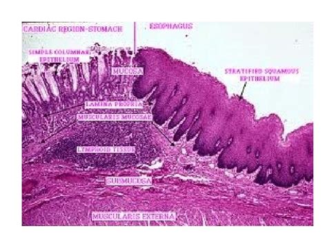 Histology Of Esophagus Gastro Esophageal Junction By Dr Sexiezpicz