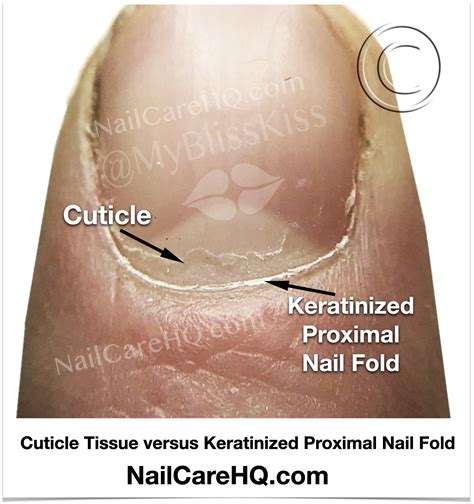 Should You Remove Cuticles Nail Care Hq