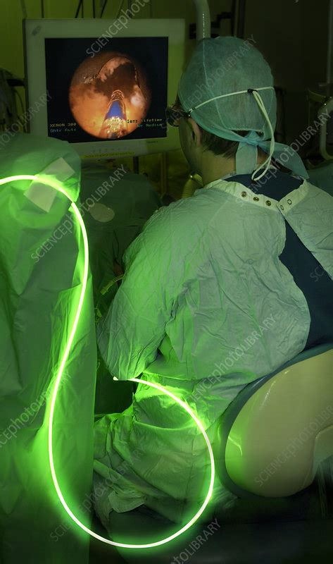 Endoscopic Prostate Surgery Stock Image M Science Photo Library