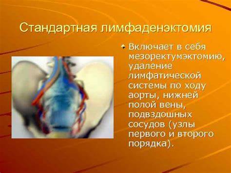 Заболевания прямой кишки диеты