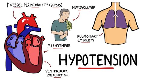 Get Low Blood Pressure Hypotension You Wish You Knew Before Butn