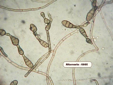 Mold Under Microscope