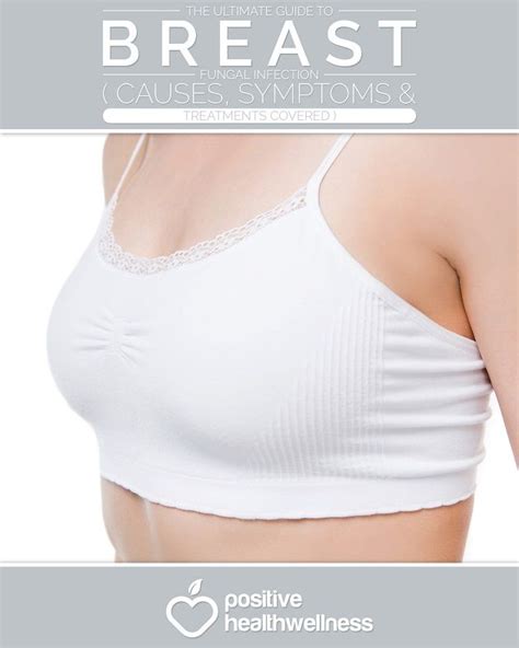 The Ultimate Guide To Breast Fungal Infection Causessymptoms And Treatments Covered Breast