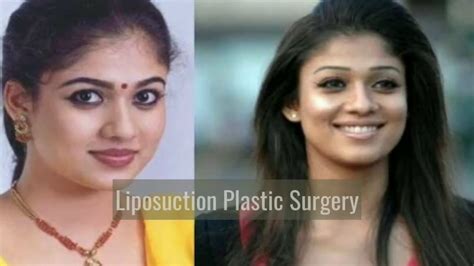 Before After Pics Of Tollywood Actresses Who Underwent Plastic Surgery