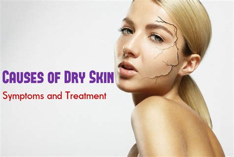 Causes Of Dry Skin Symptoms And Treatment Stylish Walks