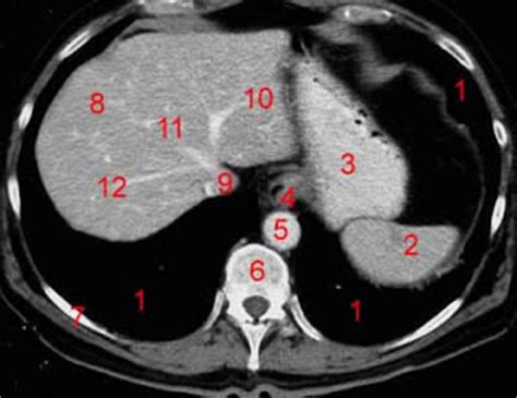 Use them in commercial designs under lifetime, perpetual & worldwide rights. RadiologySpirit: HOW TO READ CT ABDOMEN