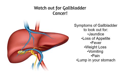 Gallbladder Cancer Fusion Radiology