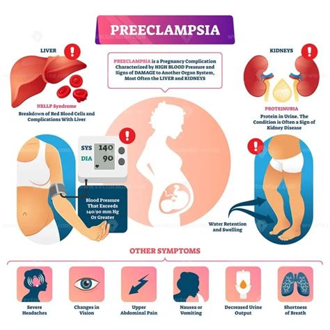 Gestosi O Preeclampsia Sintomi Cause Diagnosi E Cura Hot Sex Picture