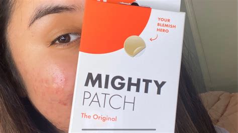 Mighty Patch Review On Acne Prone Skin Youtube