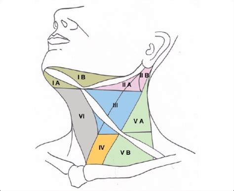 Diagrammatic Schema Of The Neck Showing Nodal Levels