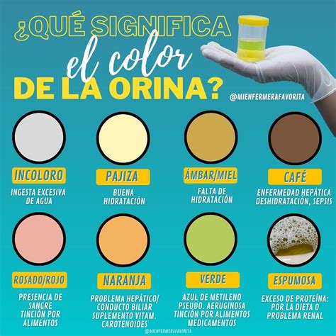 Lista 101 Imagen El Color De La Orina Dice Todo Sobre Tu Salud El último