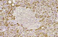 Hepatitis B Virus Liver Lesions The Digitized Atlas Of Mouse Liver