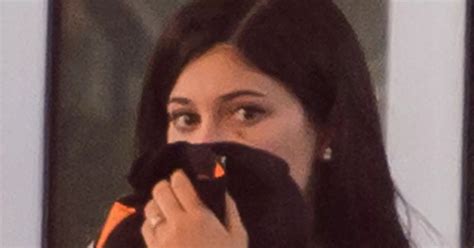 Kylie Jenner Displays Black Eye And Tries To Hide Her Face While