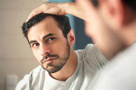 Blog Caída del cabello cinco consejos para prevenir la calvicie Biocres prevenir es fortalecer