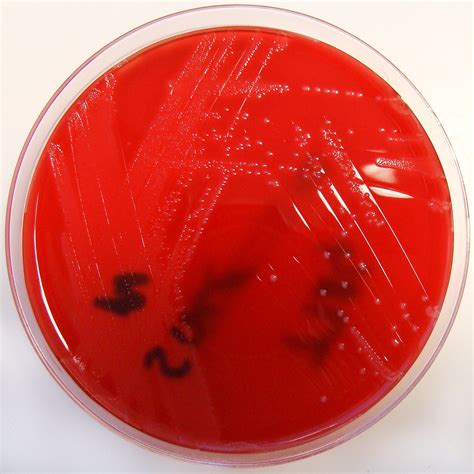 Enterococcus Faecalis On Columbia Horse Blood Agar Flickr