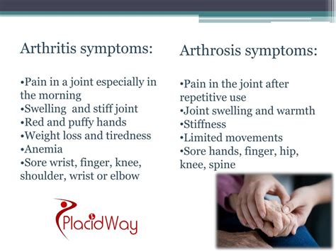 Ppt Arthritis Vs Arthrosis Know The Difference Powerpoint