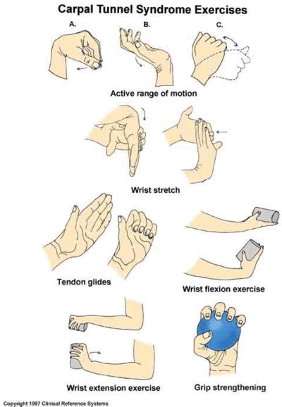 People with this condition may feel pain, numbness and general weakness in the hand and wrist. Pin by Sara Rowe on Healthy living | Carpal tunnel, Carpal ...