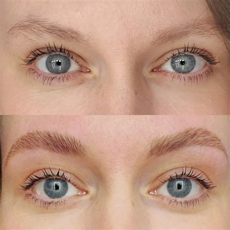 Laminated Brows Before And After Before And After