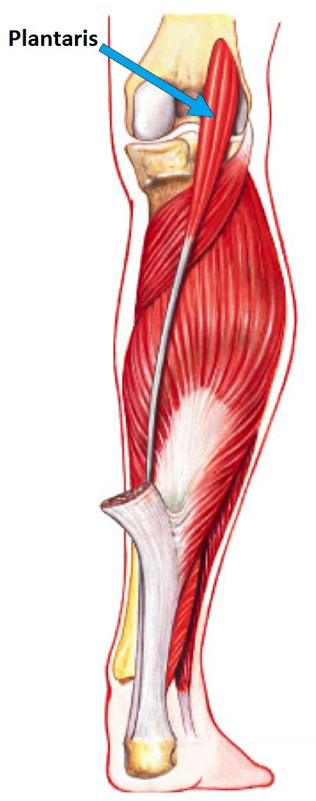 Though ligament and tendon conditions are fairly common in cats, they require prompt care in order for full mobility to. Breaking Down Serge Ibaka's Plantaris Injury - In Street Clothes