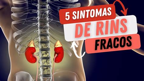 Sintomas De Rins Fracos Youtube