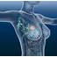 Data Collection Method For Benign Breast Disease Can Provide Insight On 