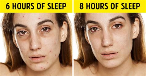 7 Thing Happens To Your Body When You Dont Get Enough Sleep