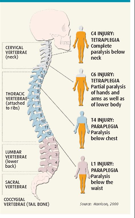 Figure 1 From The Management Of Patients With Spinal Cord Injury