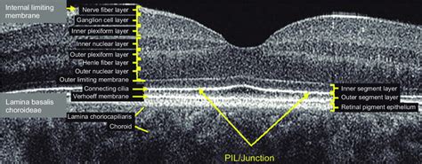 Layer By Layer B Scan Sd Oct Display Of Normal Retina Abbreviation
