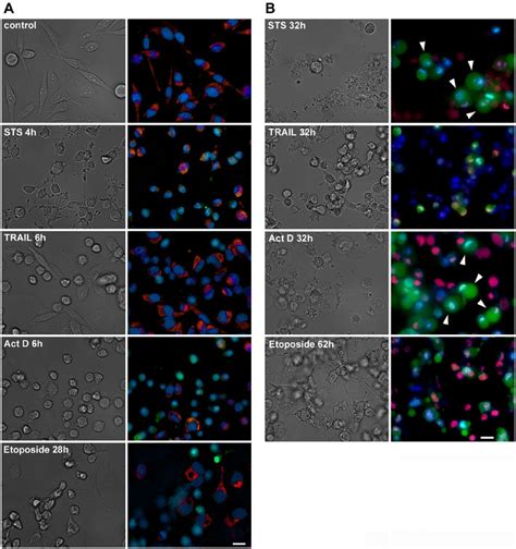 Early A And Late B Apoptosis In Hela Cells Left Column Dic Image
