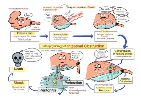 Acute Intestinal Obstruction Pathophysiology Creative Med Doses