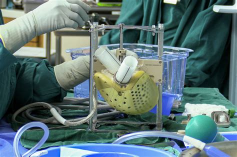 Artificial Heart Implant Is The First Of Its Kind In The Us