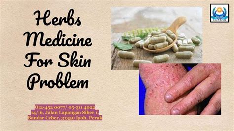 Herbs Medicine For Skin Problem Herbal Medicine Skin Problems Herbalism