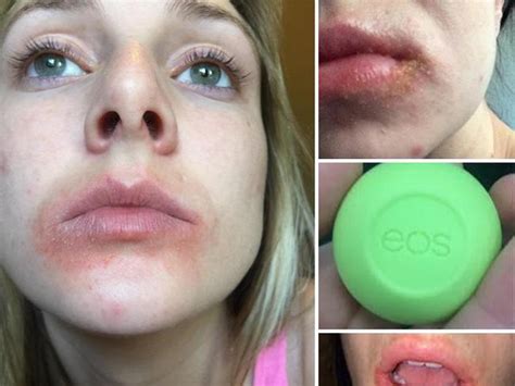 Woman Files Lawsuit Against Cosmetics Brand Eos Over Claims Its Lip