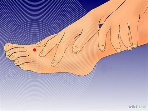 3 Ways To Cure Numbness In Your Feet And Toes Artofit