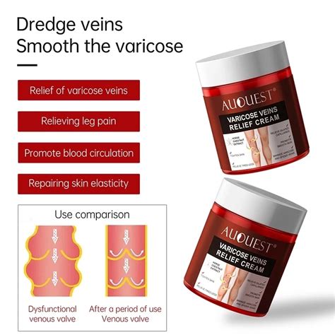Varicose Veins Relief Cream Vasculitis Phlebitis Spider Pain Relief