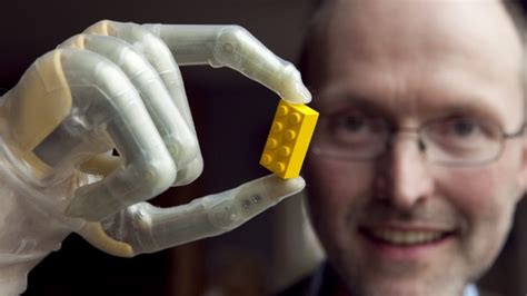 With New Bionic Fingers Partial Hand Amputees Regain Motor Skills Zdnet