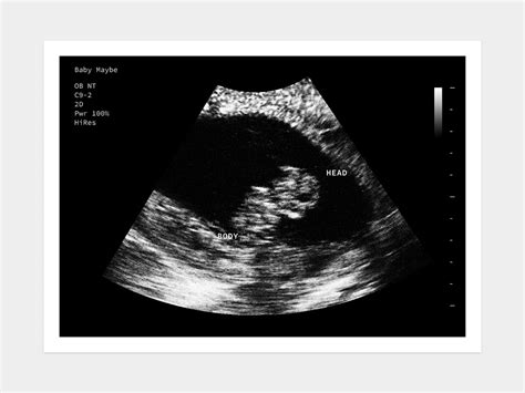 8 week ultrasound photo
