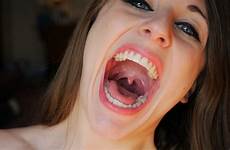 yawning uvula marz
