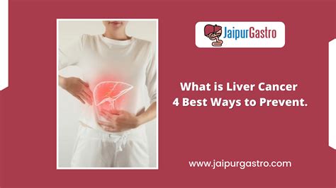 What Is Liver Cancer Symptoms Causes And 4 Ways To Prevent