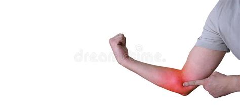 Close Up Of A Man With Elbow Inflammation Colored Red Suffering From