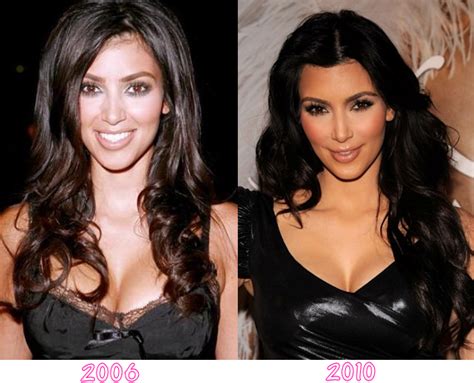 Sections show more follow today plastic surgery might not only help make people. Kim Kardashian Before and After Plastic Surgery ...