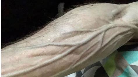 Veins Popping Out