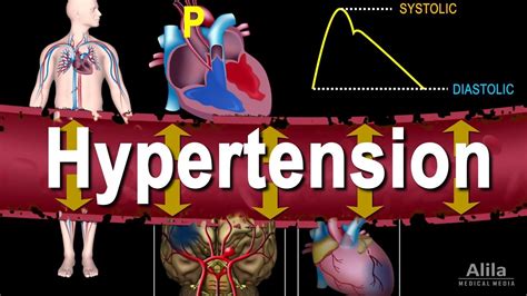 Hypertension High Blood Pressure Animation Youtube