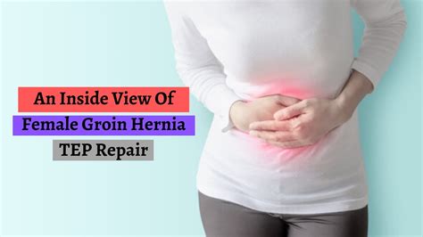 An Inside View Of Female Groin Hernia Tep Repair Youtube