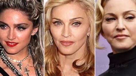 Madonna Before And After Plastic Surgery Journey Vanity