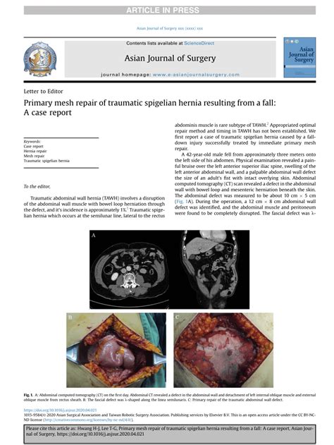Pdf Primary Mesh Repair Of Traumatic Spigelian Hernia Resulting From